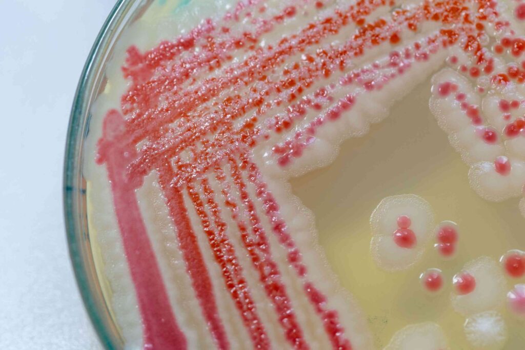 Symptoms Of Pink Mold Exposure: Recognizing The Uncommon Fungal Intruder